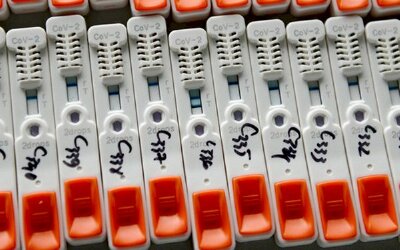  Bộ kit test nhanh COVID-19 giá gốc chỉ 35.000 đồng, trong nước tăng gấp nhiều lần? Thứ trưởng Bộ Y tế chính thức lên tiếng