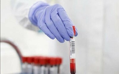 Lý do Bộ Y tế đề xuất tạm dừng thông báo số ca mắc COVID-19 hàng ngày